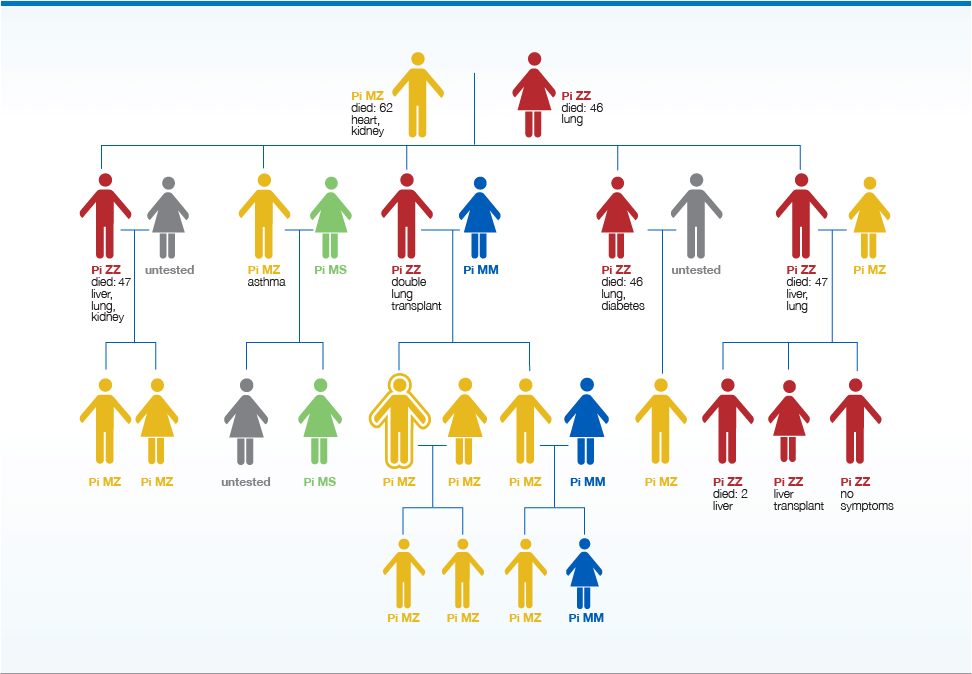 Family tree chart showing an actual family tested for alpha-1